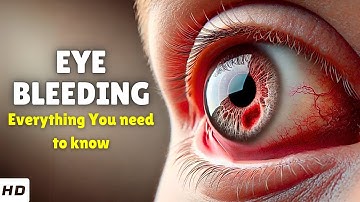 Eye Bleeding Explained: Hidden Causes, Treatments & When It’s Dangerous!