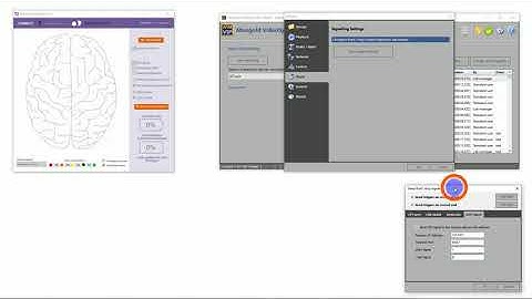 Trigger Smarting EEG by Mangold VideoSyncPro Studio