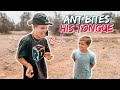 TEEN TRIES TO EAT A RED ANT | * INSTANT KARMA* GETS BIT ON THE TONGUE INSTEAD