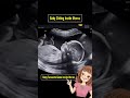 #babyhealth #duet #baby #and #babyheartbeat #pregncy #fetalheartbeat #pregnan #cutebaby