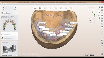 How to create an Implant Bridge with Gingiva Order in 3Shape Dental System 2015