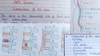 Potts disease (part-2)/ Tuberculosis of the spine
