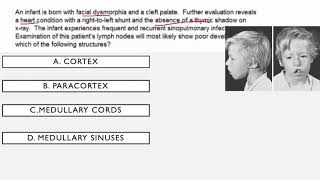 Immunodeficiency Syndromes USMLE Questions