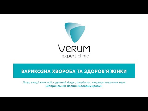 Варикозна хвороба і здоров&rsquo;я жінки