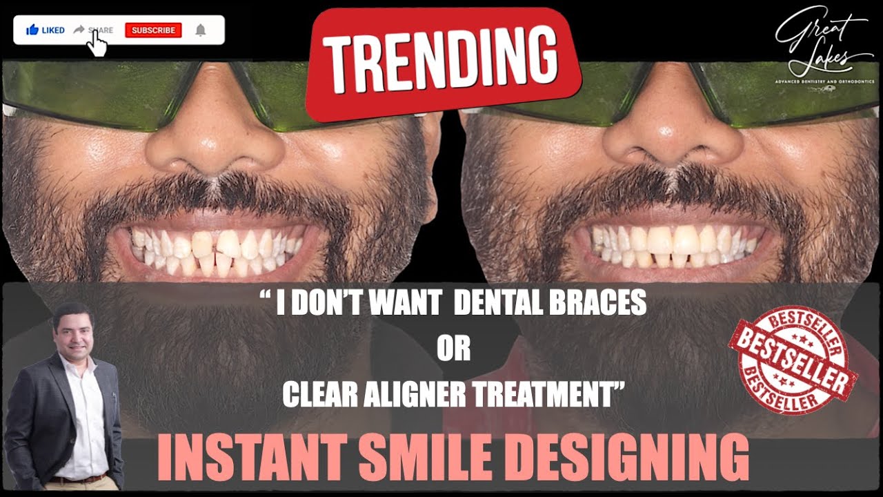 Dental Capping Treatment Dental Cap Cosmetic Dentistry Cosmetic