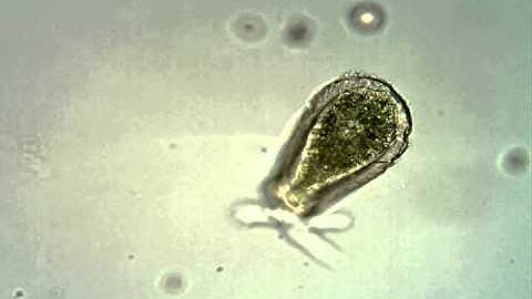 Microscope 40X objective test (Hyalosphenia)