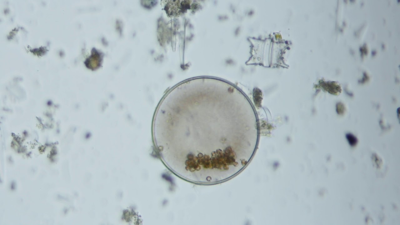 Unidentified Antarctic Microbe (Circle) (50x) from McMurdo Sound Seafloor
