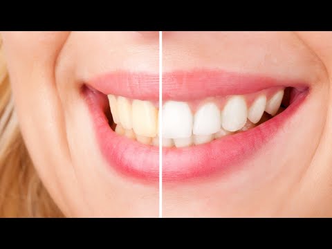 ✅ TOP 5: Best Whitening Toothpaste 2019