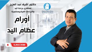 أورام عظام  اليد | دكتور أشرف عبدالعزيز | استشاري جراحات اليد