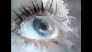 skin eye (glitch/datamoshing)