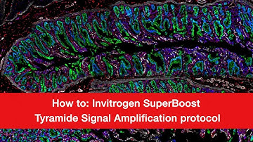 How to: Invitrogen SuperBoost Tyramide Signal Amplification Protocol