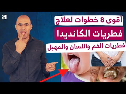 فيديو: هل يمكنني مقاضاة طبيبي بسبب الإفراط في العلاج؟