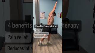 Celebrity Would you try cupping? It’s an ancient technique for treating and increasing blood flow Net Worth