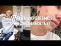 VLOG: MICRONEEDLING  FOR THE FIRST TIME