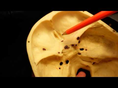 Video: Frattura Lineare Del Cranio