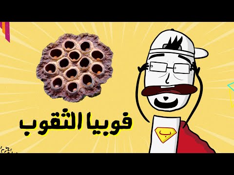 مع بندق ليش في ناس بتخاف من الثقوب