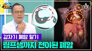 건강검진도 소용 없는 무증상 폐암 말기 진단! ๏̯๏ 림프샘까지 전이된 폐암.. | 나는 몸신이다 435 회