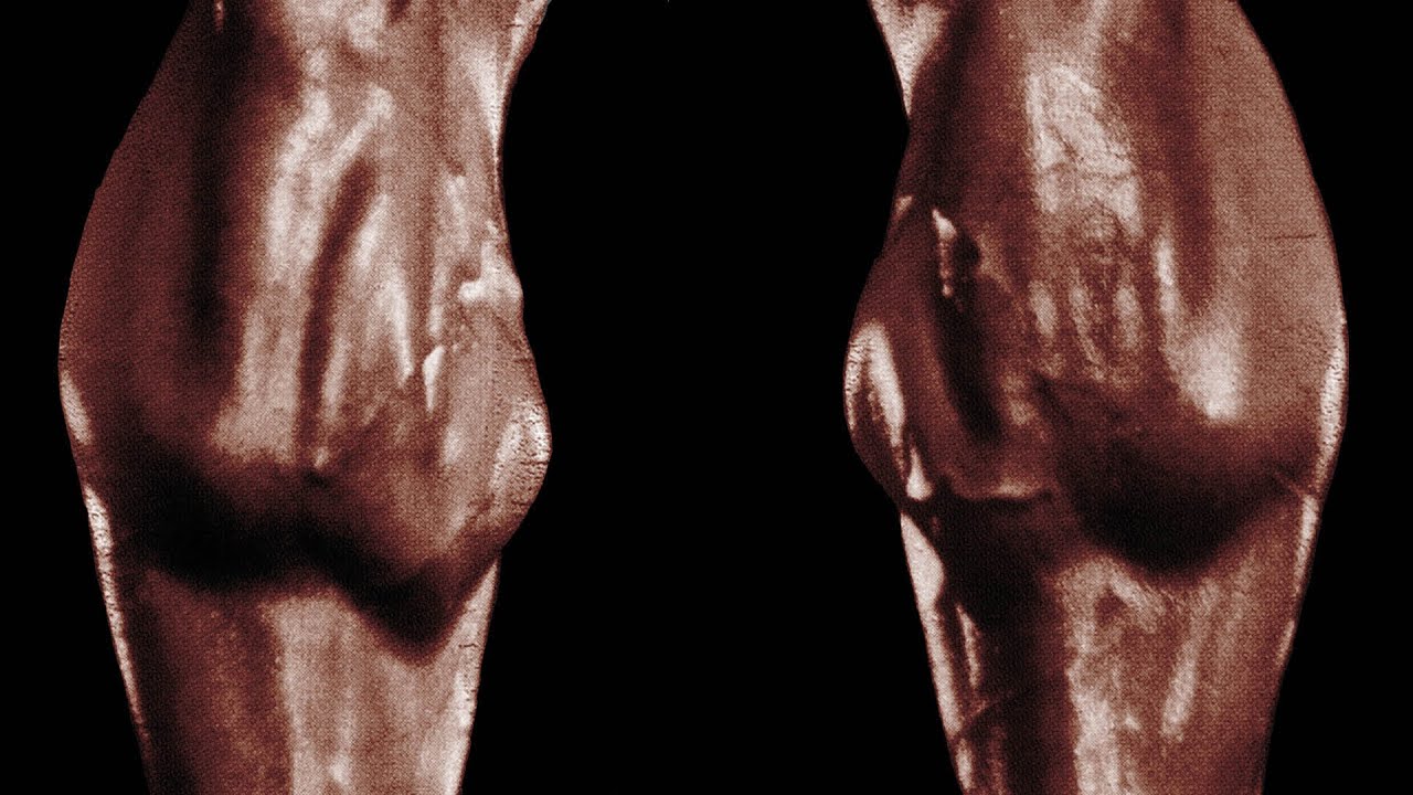 Arnold Schwarzenegger's Unique Calves Part 2 YouTube