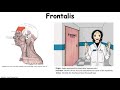 Frontalis visual learning aid