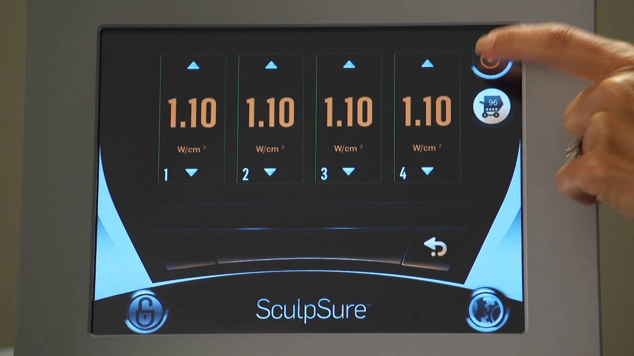 SculpSure Patient Experience Overview YouTube