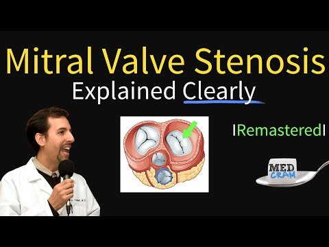 Mitral Valve Stenosis: Diagnosis