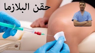 هل العلاج بالبلازما له لزمة؟ |حقن الركبة بالبلازما|دكتور احمد حسن جمعه