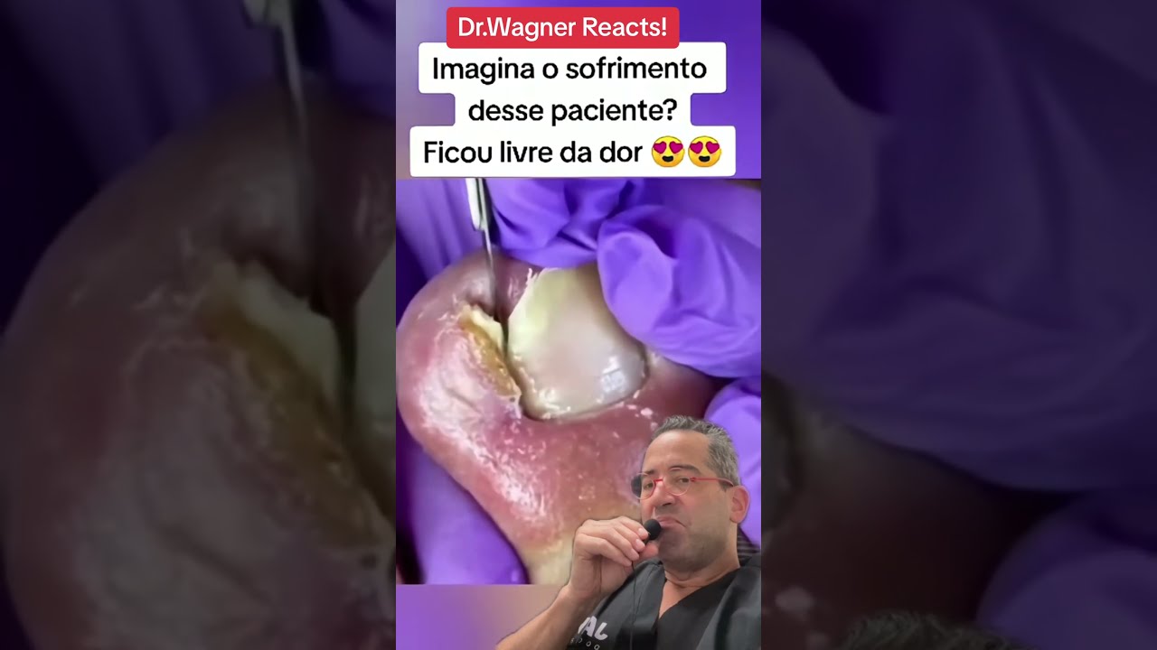 MONSTER INGROWN TOENAIL Shorts