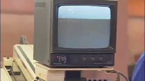 The Iron core of Distribution Transformers