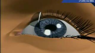 видео Астигматизм глаз что это за болезнь, как ее лечить у