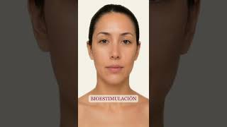 💉 Bioestimulación: activación progresiva de colágeno