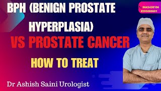 प्रोस्टेट ग्रंथि बढ़ने के कारन और उपचार। Prostate disease awareness