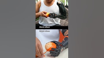 Vulcan Full Porsthetic Hand Solution #disability #prosthetics #bionics #robot  #shorts #challenges
