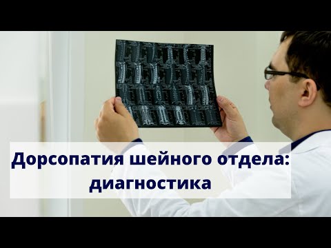 Дорсопатия шейного отдела