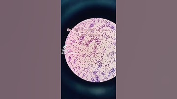 Gram positive cocci identification #bacteria #staphylococcus #microscope