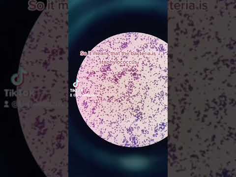 Video: Miks on Staphylococcus aureus grampositiivne?