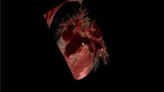 Ambivu human lung volume rendering .avi