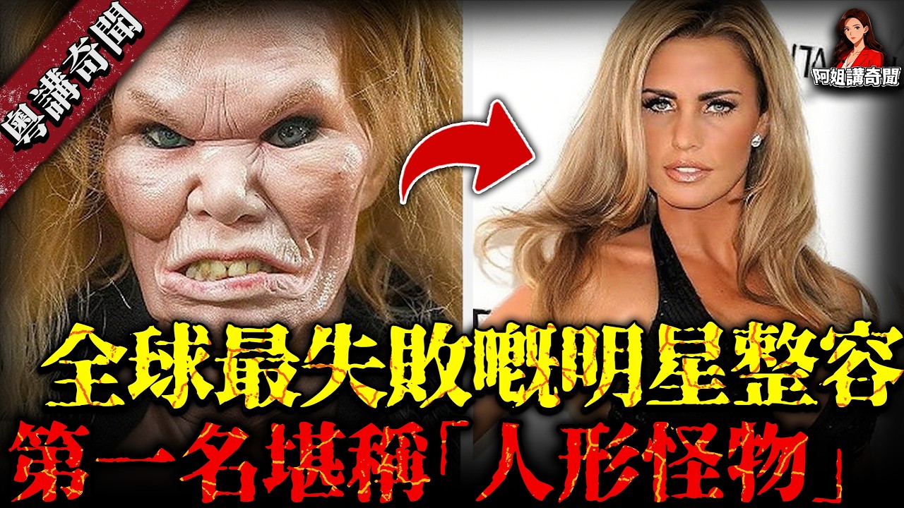 全球最失敗明星整容 TOP10！燒數百萬變貓女，一日十次手術整到親生父母都認唔出！【阿姐講奇聞】未解之謎｜歷史｜神秘學
