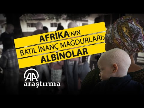Afrika'nın Batıl İnanç Mağdurları: Albinolar