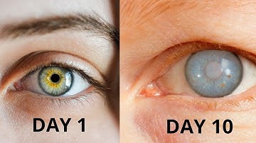 What if Ozone Layer Disappeared?