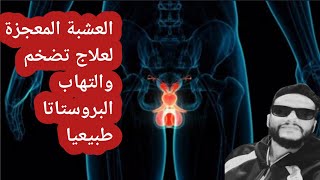 افضل علاج طبيعي لي تضخم والتهاب البروستاتا مع شرح اعراض البروستاتا