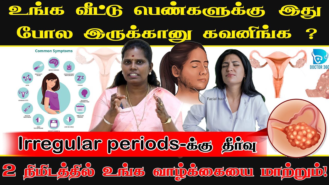 Irregular periods க்கான காரணம் என்ன? | நீர்கட்டி முழுமையான தீர்வு ! #pcod #pcos #doctor360 #dr360
