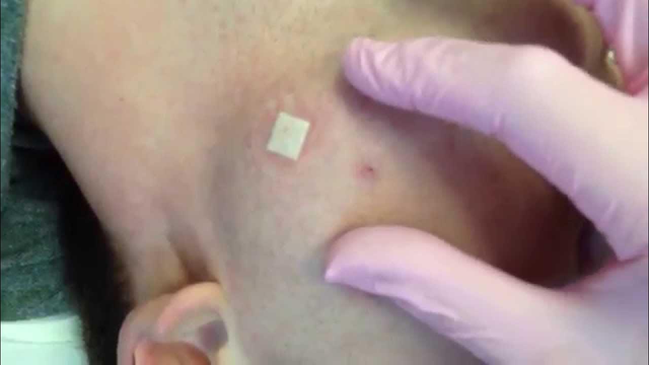 Siktyvkarda jinsiy ozchiliklar yigilishi