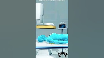 Atherectomy procedure to clear blocked arteries 3D animation #drone #theflash #space #voluson