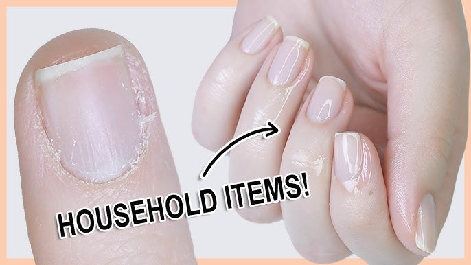 How to Take Care of Nails: Expert Tips for Healthy Growth