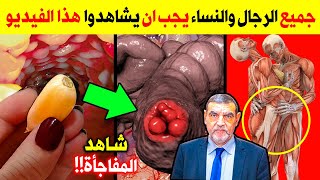 معلومات ونصائح لتناول الثوم