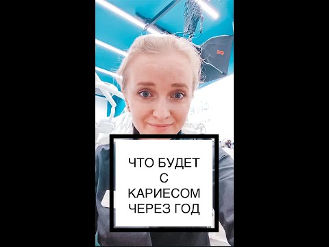 ЧТО БУДЕТ С КАРИЕСОМ ЧЕРЕЗ ГОД  #shorts