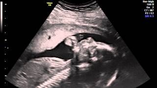 IMG 20141217 1 2