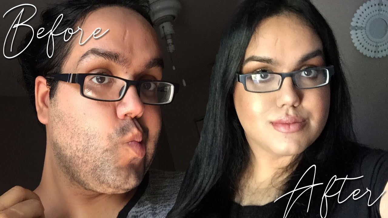 TRANSGENDER Facial Laser Hair Removal Demi Medina YouTube