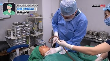 얼굴지방흡입 공개! 흡입과정과 기대효과는?