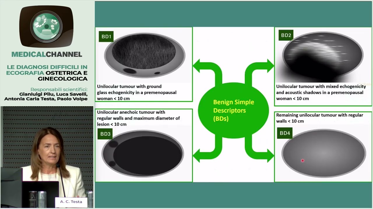 Cisti multiloculari in gravidanza. Diagnosi banale o difficile? - A. C. Testa